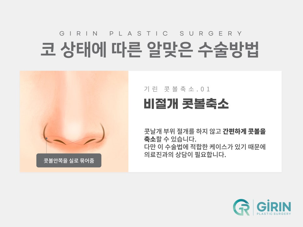 콧볼축소수술후기 주의한 점은 관련 이미지 4