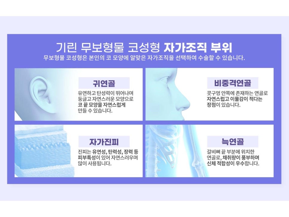 코재수술성형외과 신중하게 선택해 관련 이미지 7