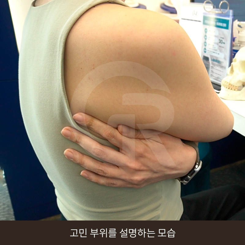 요가로 소용없던 굵은 팔뚝 지방흡입 수술 후기 관련 이미지 2