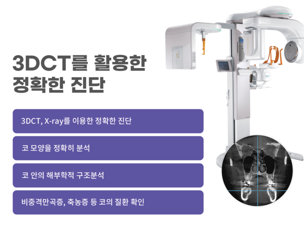 콧볼축소술 세련된 인상을 원한다면 관련 이미지 4