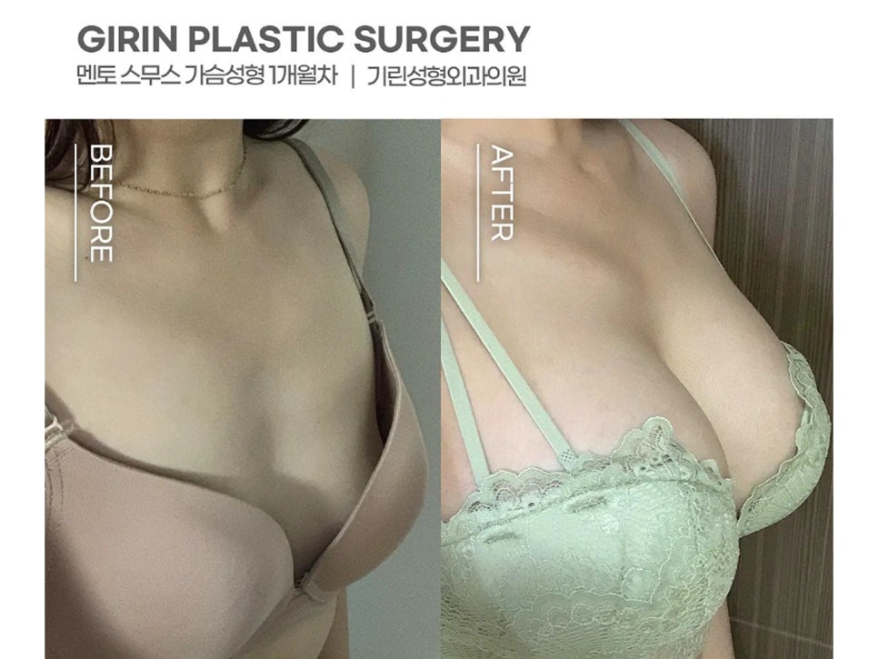 멘토엑스트라 자연스러운 촉감 관련 이미지 10