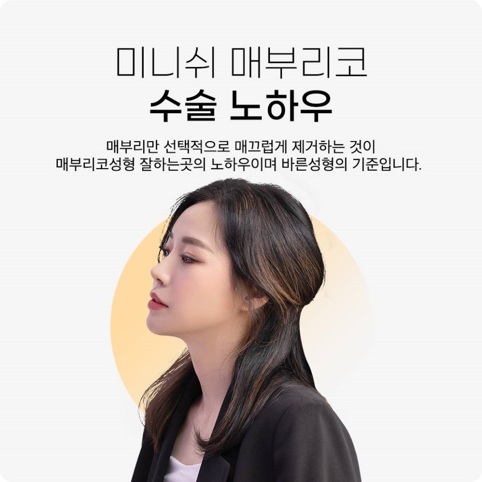 매부리코수술후기, 별로 도움 안 된다? 관련 이미지 2