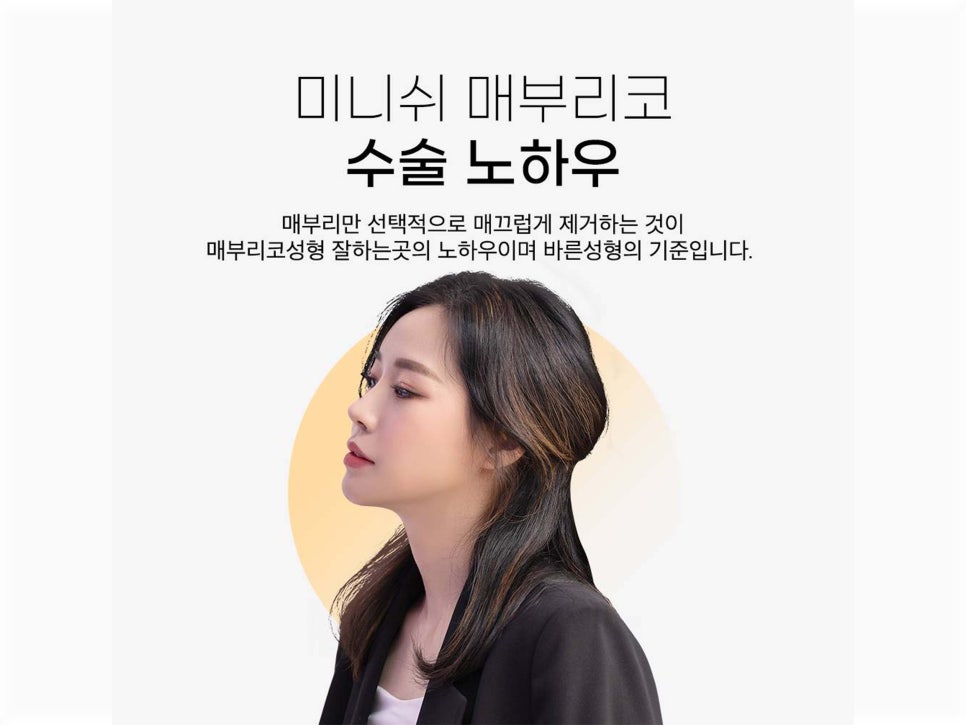 매부리코수술후기 올바른 라인으로 관련 이미지 12