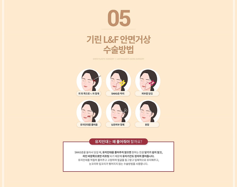 안면거상술효과 만족스러울려면? 관련 이미지 11