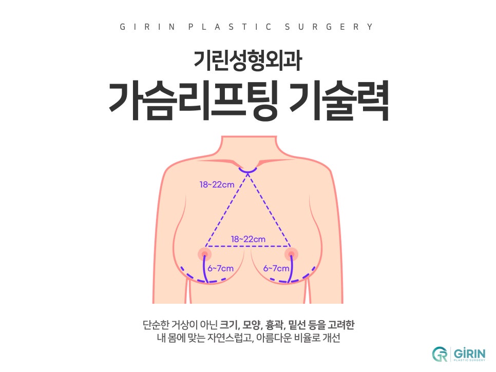 가슴거상술 흉터에 대한 걱정은 관련 이미지 1
