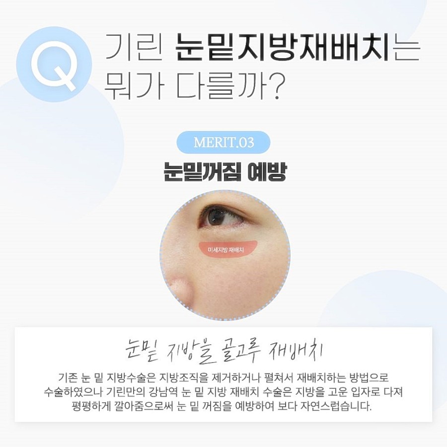 눈밑지방재배치 레이저 vs 수술후, 그동안 걱정했다면 관련 이미지 7