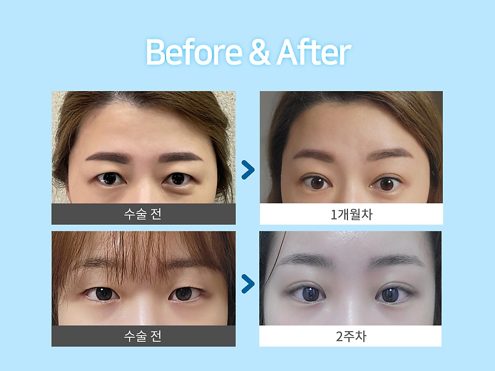 이마거상술 미리 확인해야 할 부분은? 관련 이미지 10