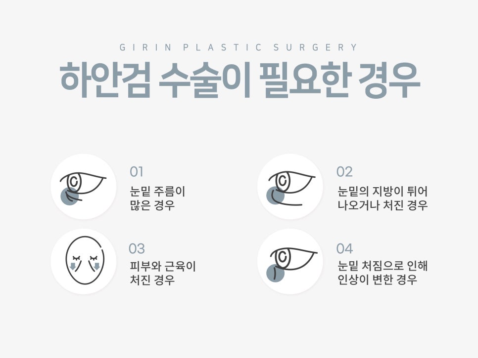 강남눈성형 눈매 개선 만족스럽게 관련 이미지 8