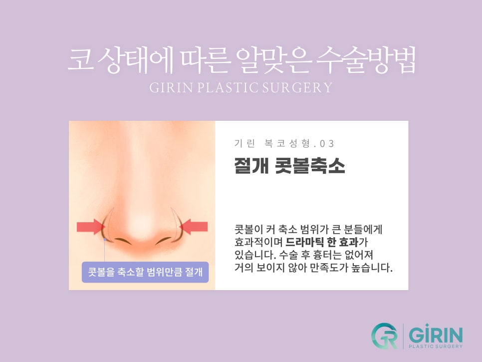 복코성형후기 세련미 있는 코 원한다면 관련 이미지 9