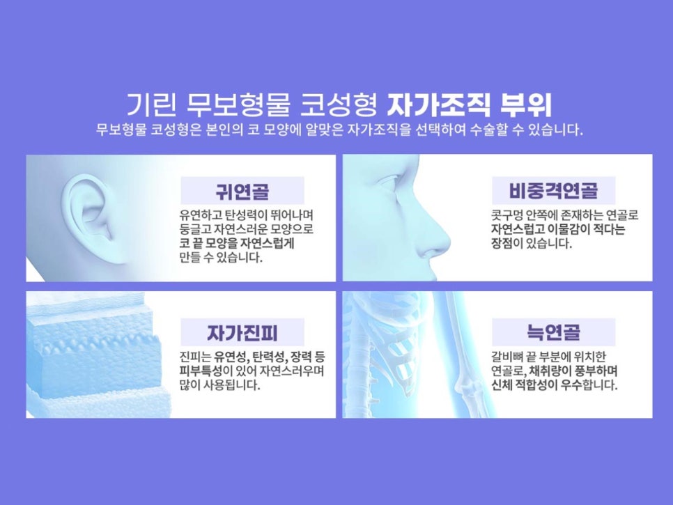 강남코재수술 신중하게 고르자 관련 이미지 8