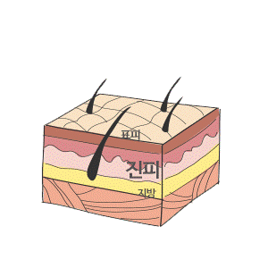 무보형물 코성형이란? 자가진피, 늑연골, 귀연골, 비중격연골 알아보기 관련 이미지 2