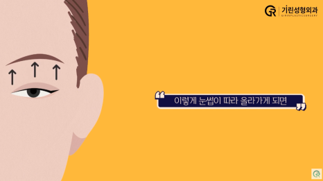 [기린성형외과] 어제보다 오늘 더 젊어지는 기린 이마거상_이마거상 Q&A 관련 이미지 3