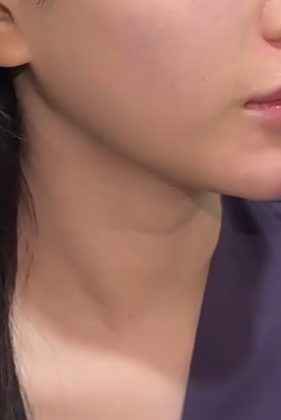 일요일에도 리프팅 가능한 이유 기린성형외과 관련 이미지 1