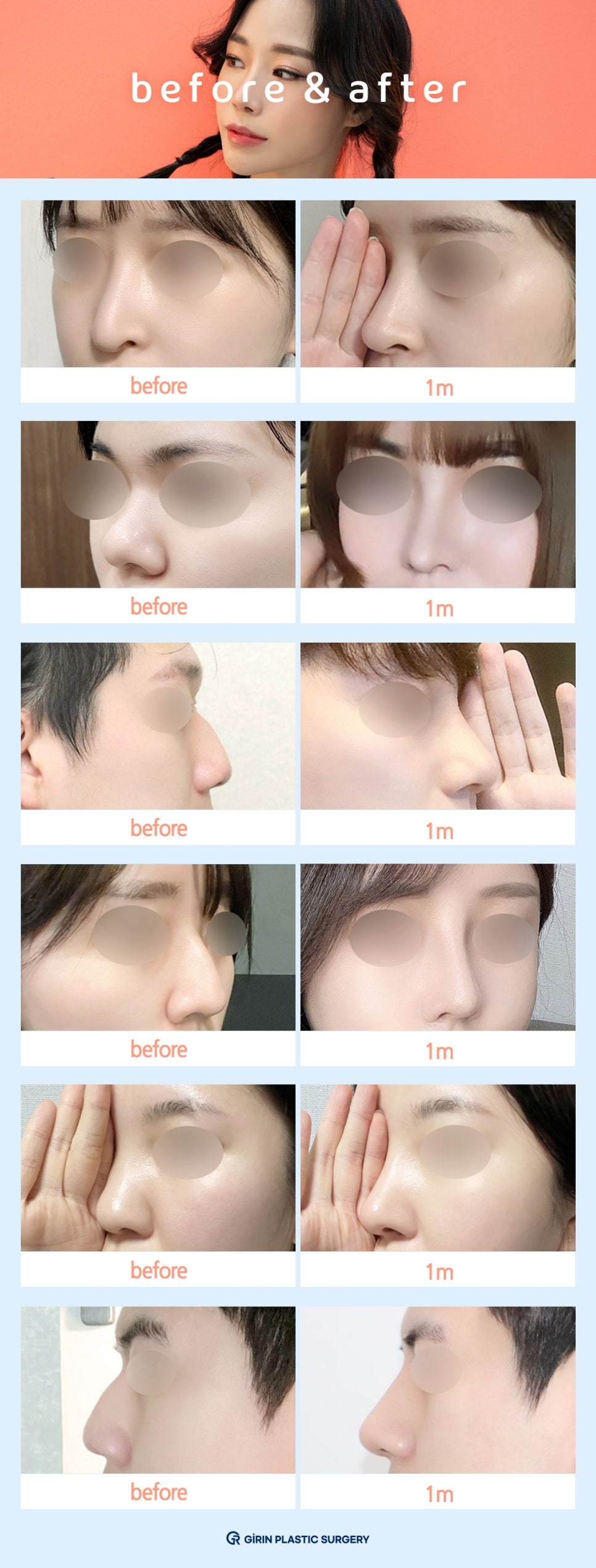 콧대높이기? 관련 이미지 15