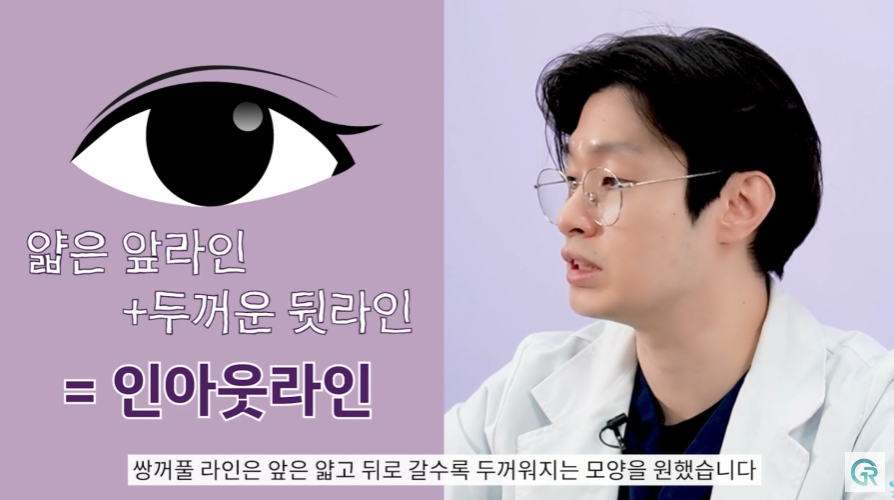 [기린성형외과] 작고 답답한 눈, 뭉뚝하고 낮은 복코 탈출!_눈성형, 코성형 수술일지 관련 이미지 5