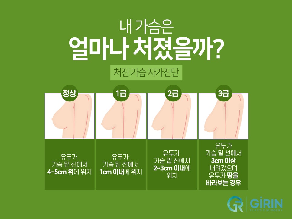 처진가슴수술후기 비교하며 선택한다면 관련 이미지 4