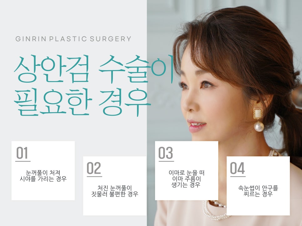 중년눈성형 우아하게 잡아주며 관련 이미지 6