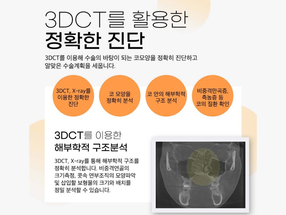 매부리코수술후기 올바른 라인으로 관련 이미지 14