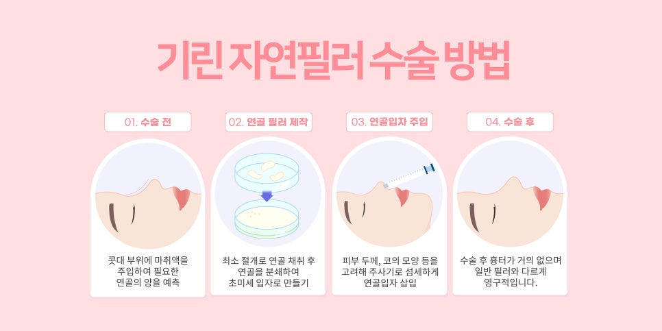 서울코재수술 마지막으로 살펴볼것 관련 이미지 12