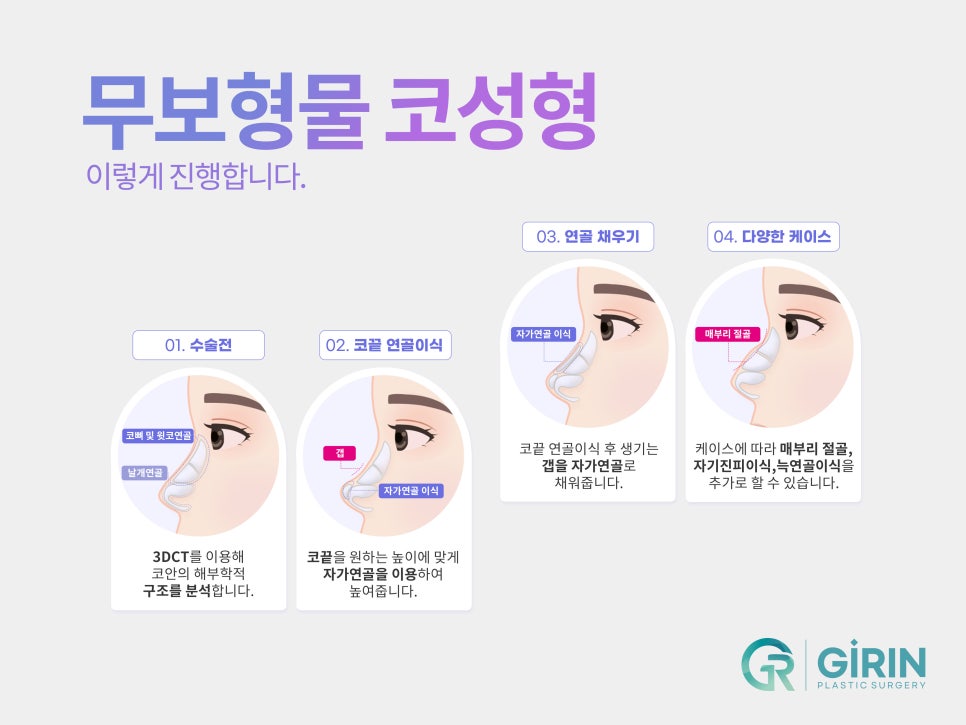 강남코수술잘하는곳 궁금했다면 관련 이미지 9