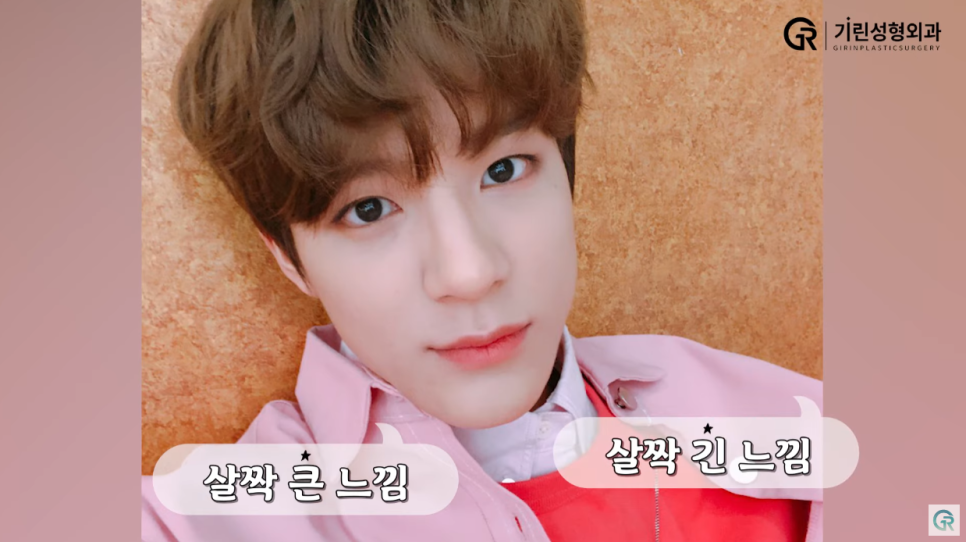[기린성형외과의원] 얼굴천재 NCT DREAM_성형외과 전문의 얼굴분석 관련 이미지 12
