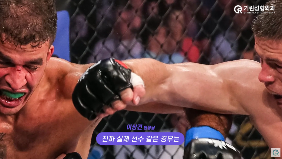 [기린성형외과의원] 코성형 후 격한 운동해도 될까?_코성형 주의사항 관련 이미지 5