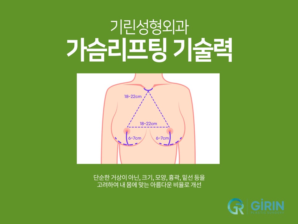 처진가슴수술후기 비교하며 선택한다면 관련 이미지 3