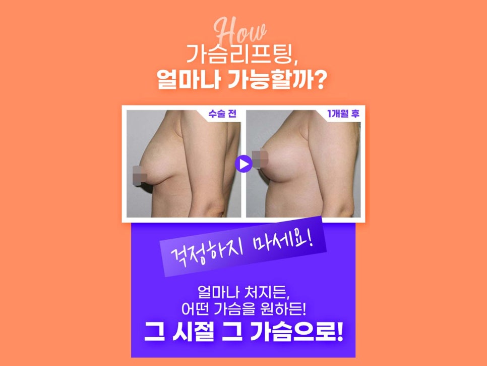 신논현 성형외과 가슴 거상 흉터가 걱정이라면 관련 이미지 3