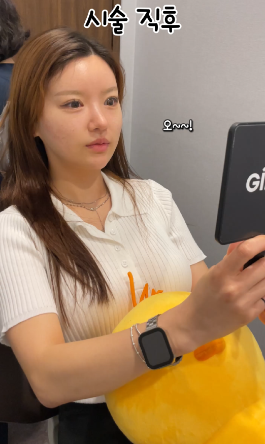 기린성형외과 쥬베룩볼륨 팔자주름, 앞볼, 관자 후기 관련 이미지 7