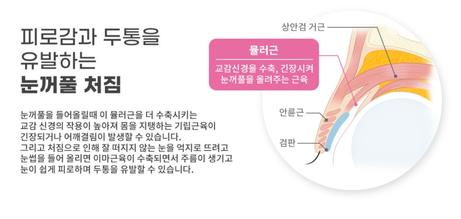 상안검수술잘하는곳 이유가 있다! 관련 이미지 2