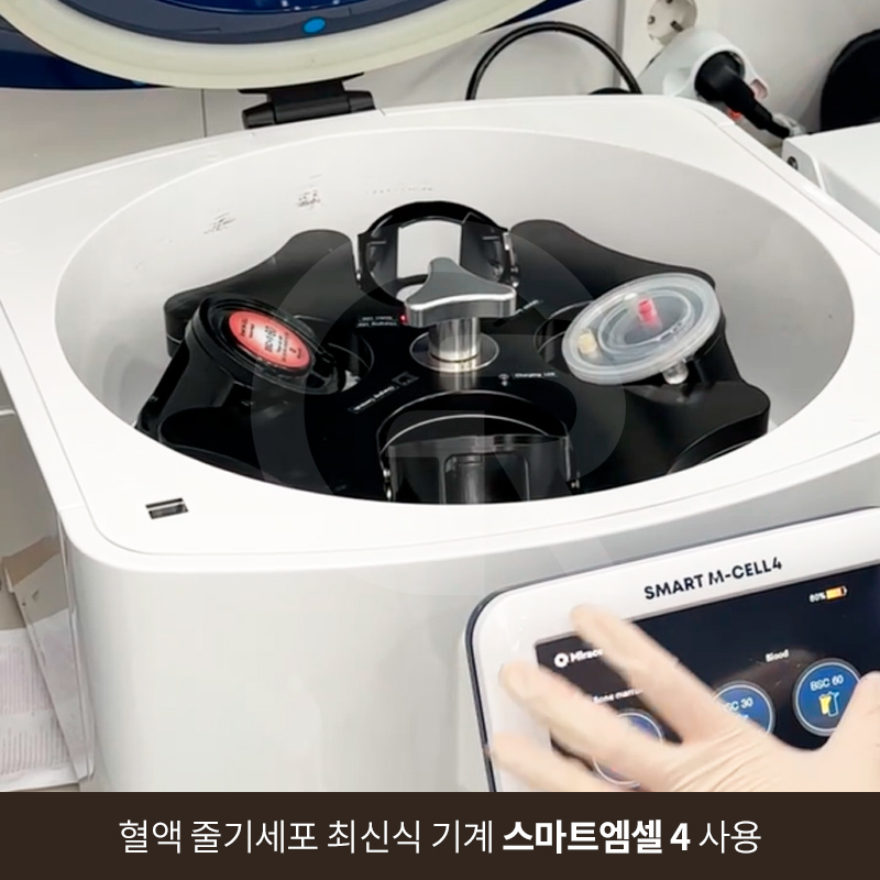 탈모 고민 두피 줄기세포 치료, 가격이 다른 이유는? 관련 이미지 3