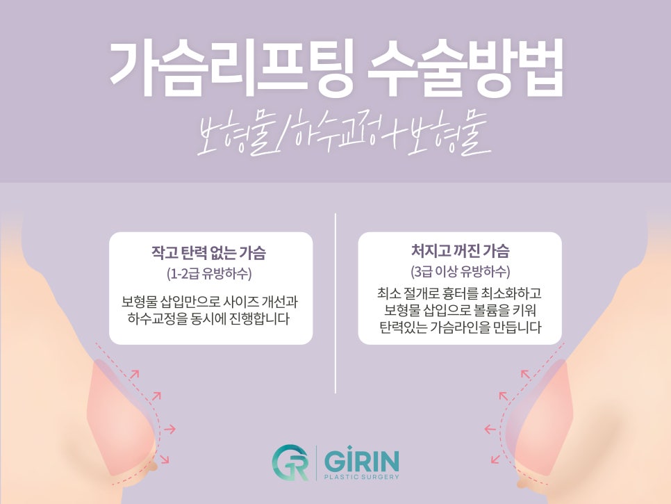 가슴거상술 변화를 기대하며 관련 이미지 4