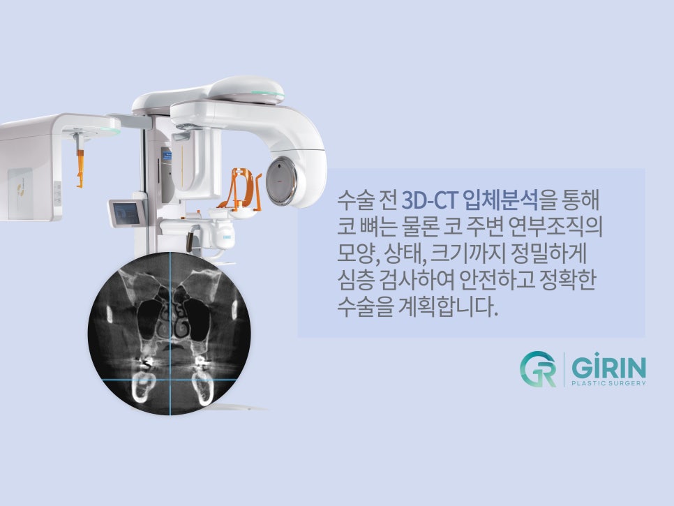 강남성형외과순위 선택은 신중하게 관련 이미지 4