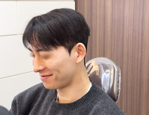 남자 미니젤리코 사례로 보는 코시술 후기 관련 이미지 5