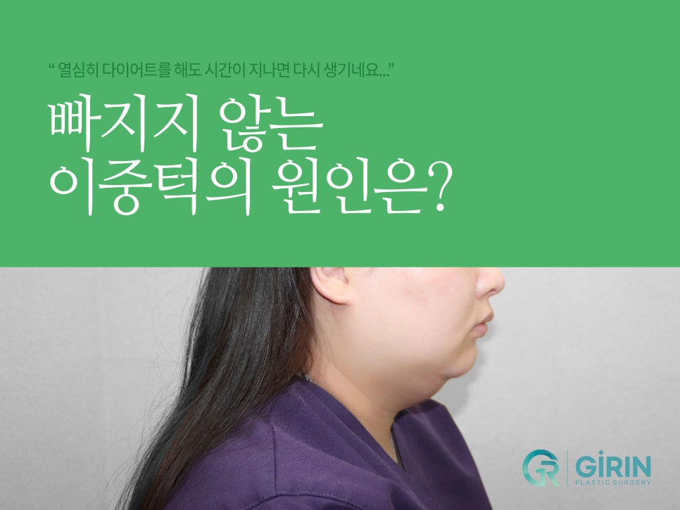 이중턱수술 확실히 효과 보려면 관련 이미지 1