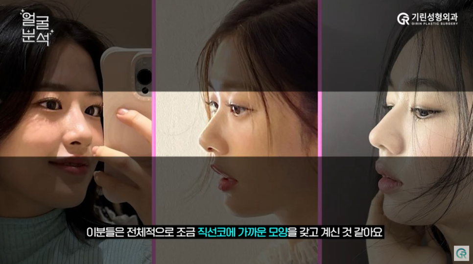 [기린성형외과의원]_자매 아닌가요? 안유진, 정소민, 안은진 얼굴분석 관련 이미지 9