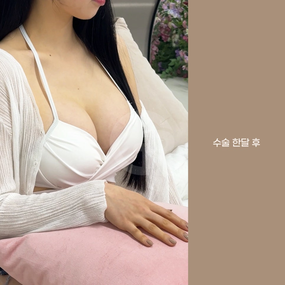 기린성형외과 가슴성형 패션 인플루언서의 고민 해결 관련 이미지 5