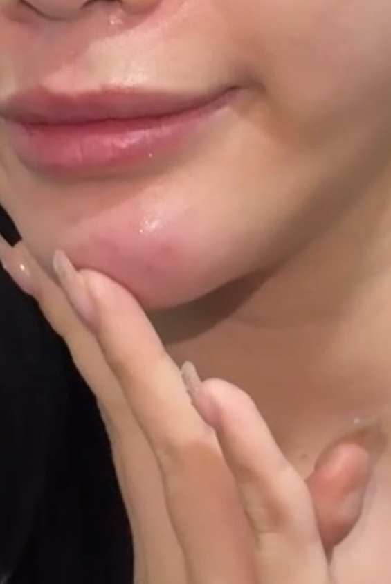 일요일에도 리프팅 가능한 이유 기린성형외과 관련 이미지 14