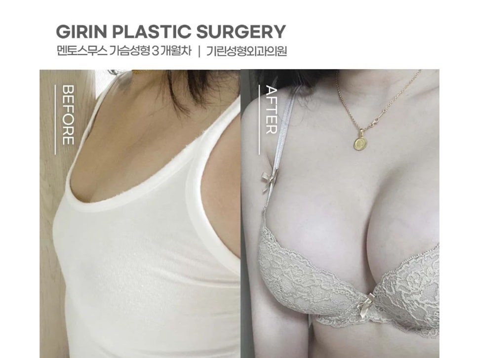 멘토엑스트라 자연스러운 촉감 관련 이미지 14