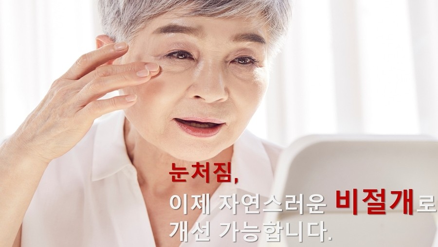 이마눈썹거상술 눈처짐 자연스럽게 눈가 리프팅 효과처럼! 관련 이미지 1