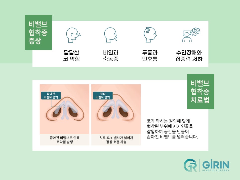 비염코성형 실비 가능성 있기에 관련 이미지 7