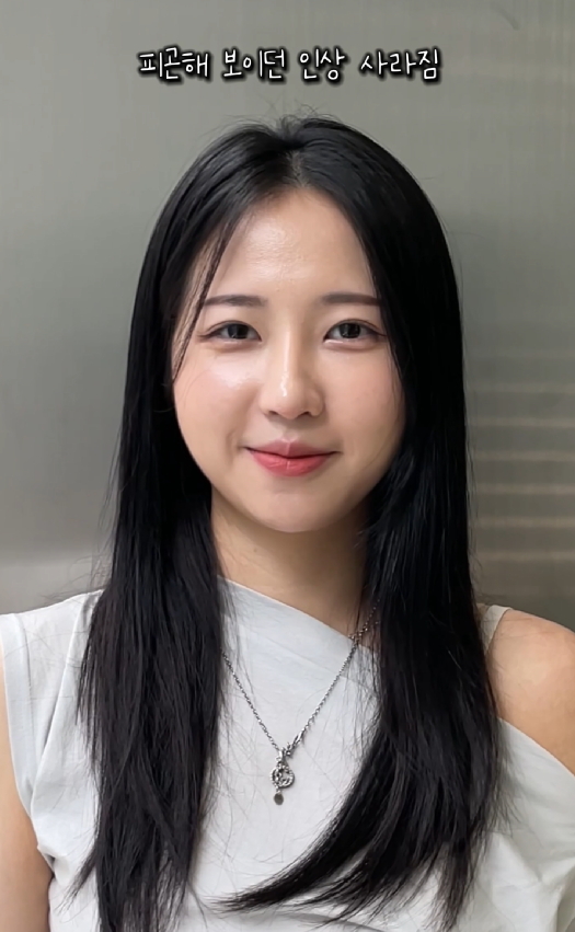 강남역 근처 쌍꺼풀 잘하는 곳 어디? 생생한 후기 관련 이미지 9