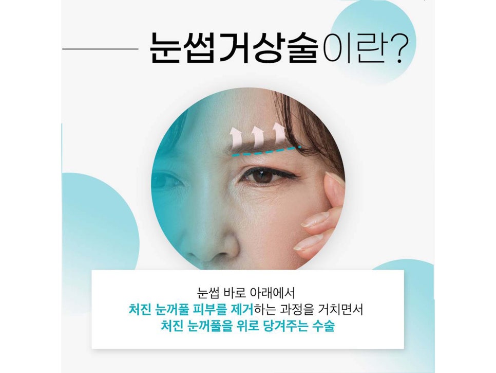 눈썹거상술흉터 걱정하고 있었다면 관련 이미지 3
