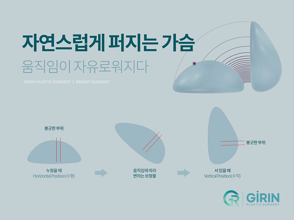 절벽가슴수술 촉감까지 고려하며 관련 이미지 17