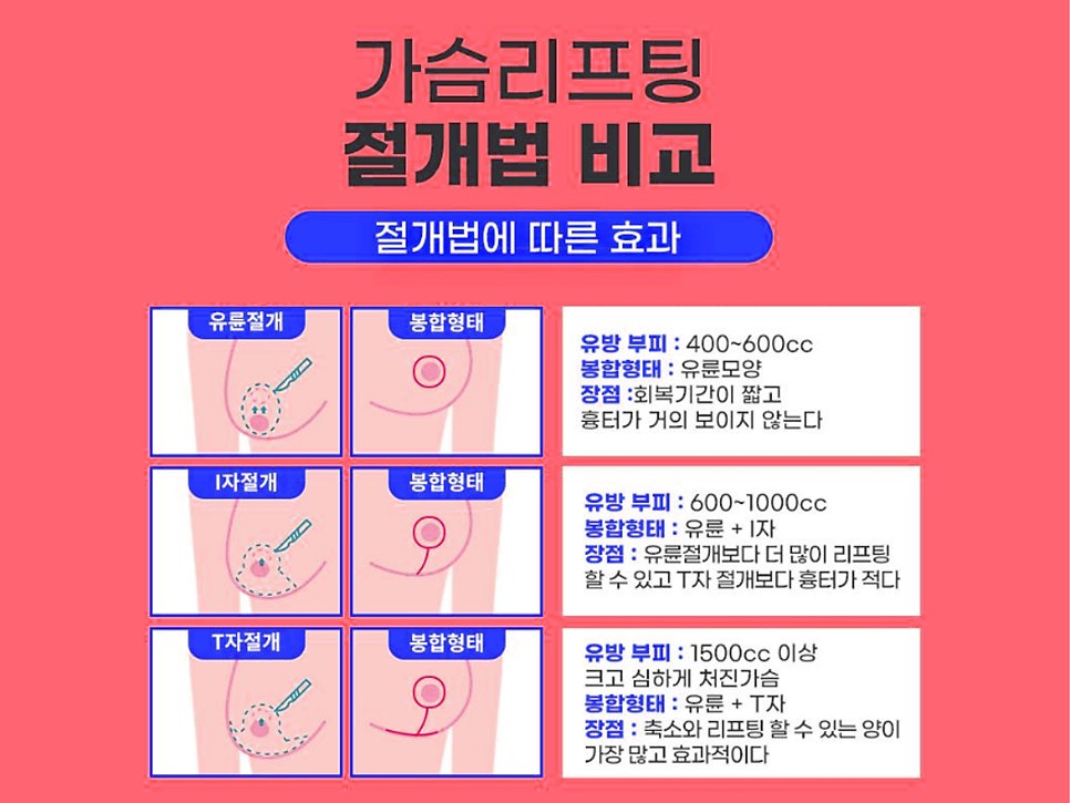 신논현 성형외과 가슴 거상 흉터가 걱정이라면 관련 이미지 9