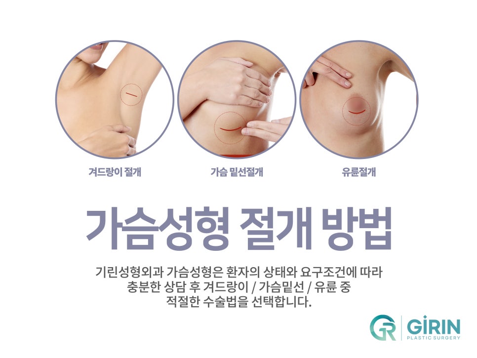강남가슴성형 달라질 라인 기대하며 관련 이미지 5