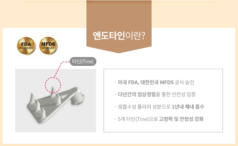 내시경이마거상술 엔도타인 효과 왜 인정받을까? 관련 이미지 4