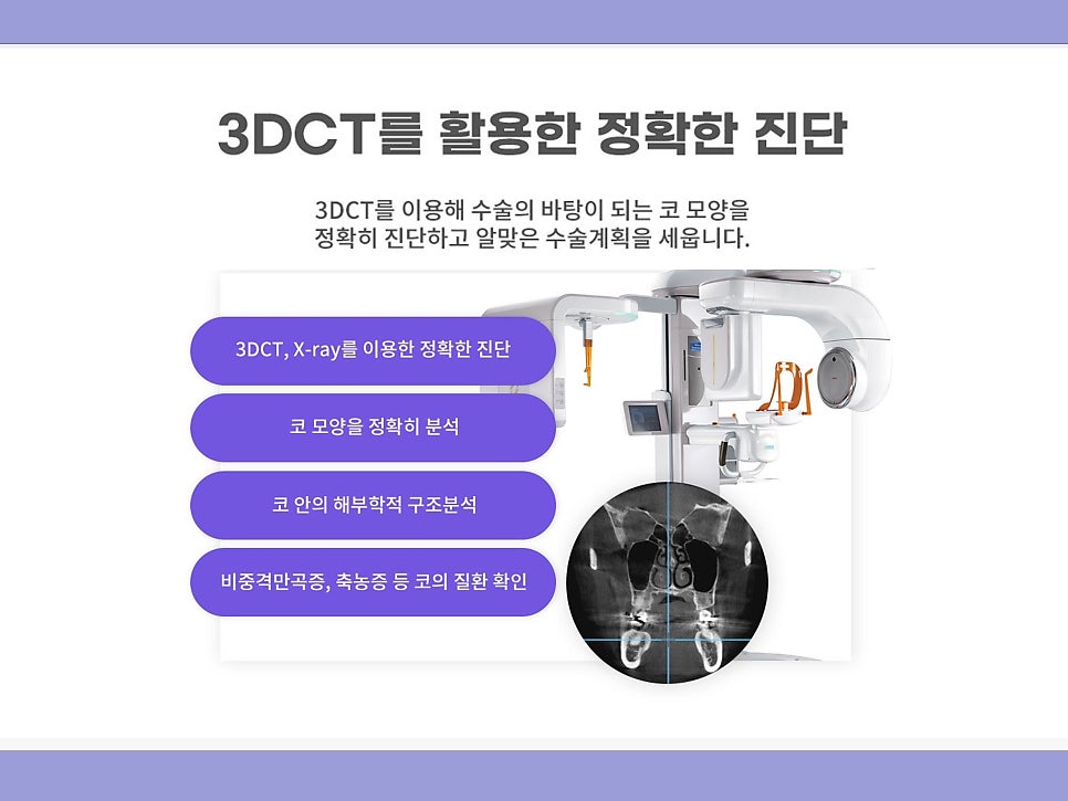 비절개콧볼축소수술 자연스럽고 예쁜 코 만들기 관련 이미지 6