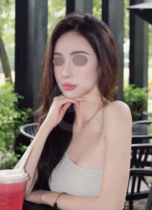 연조직윤곽술, 비대칭을 최소화하는 방법 관련 이미지 5