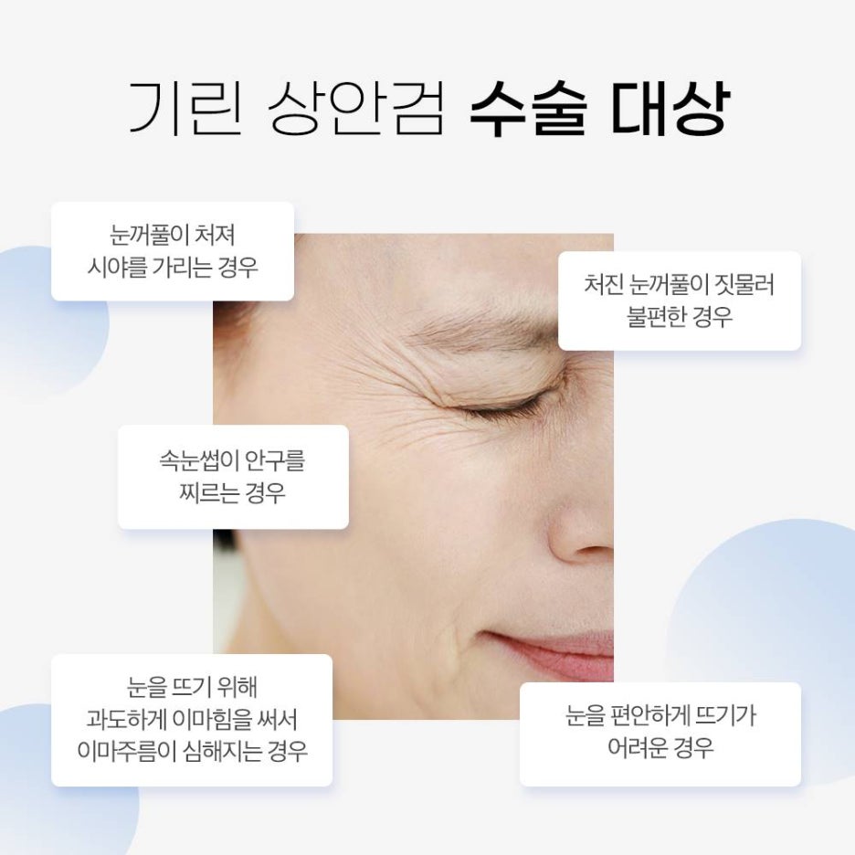기린성형외과 안티에이징 눈성형 특별한 무엇? 관련 이미지 5